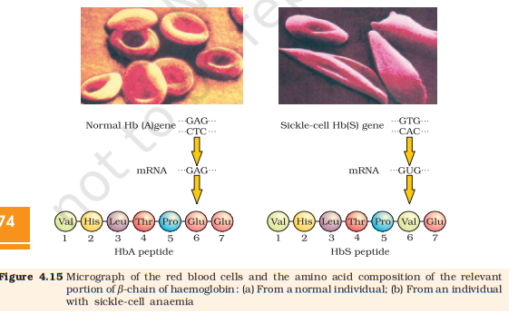 Figure 4.15 Sickle-cell anaemia — RBC & β-chain