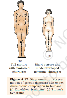 Figure 4.17 (a) Klinefelter (b) Turner syndrome